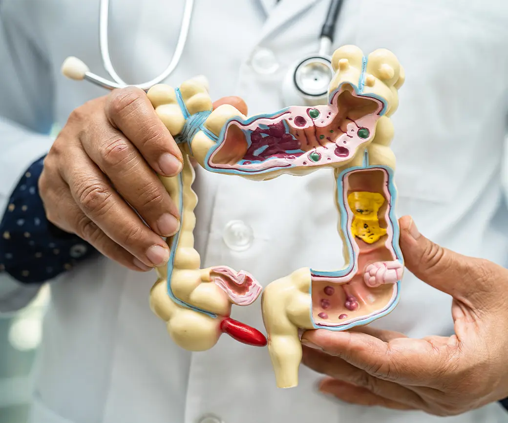 intestine-appendix-and-dige